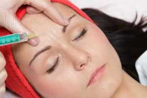 Mezoterapia igłowa - wypełnianie zmarszczek kwasem hialuronowym - rosamed-clinic