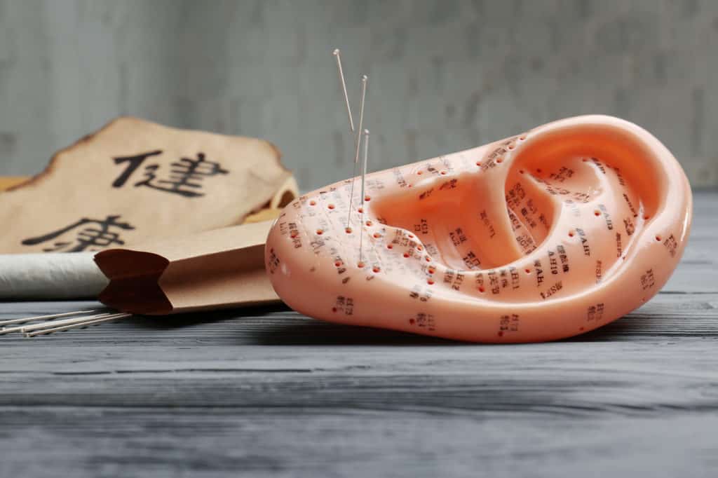 aurikuloterapia-rosamed-clinic-warszawa