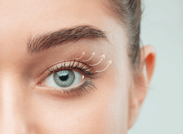 Poznaj zabieg nici PDO na opadające powieki | RosaMed Clinic Warszawa