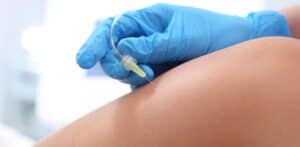 Karboksyterapia na cellulit