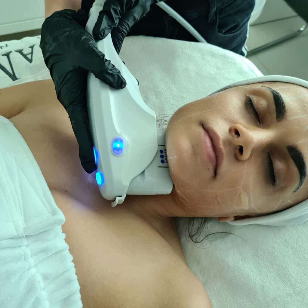 Lifting twarzy bez skalpela, zabiegi wyszczuplające twarz | RosaMed Clinic