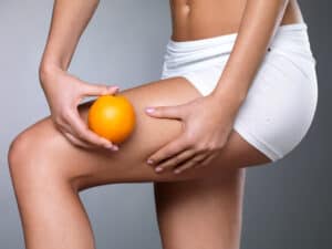Jak się pozbyć cellulitu - modelowanie sylwetki | RosaMed Clinic