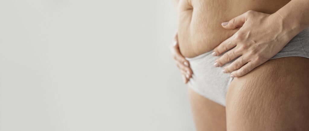 Sprawdź jak szybko schudnąć po ciąży | RosaMed Clinic