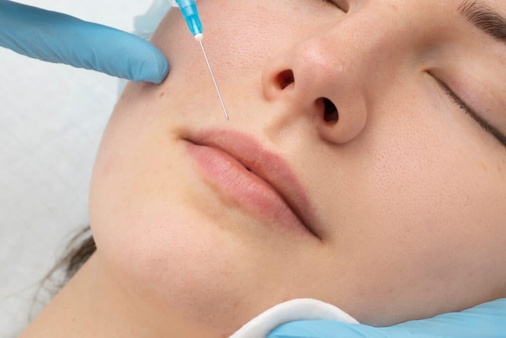 Powiększanie ust kwasem hialuronowym a botoksem | RosaMed Clinic Warszawa