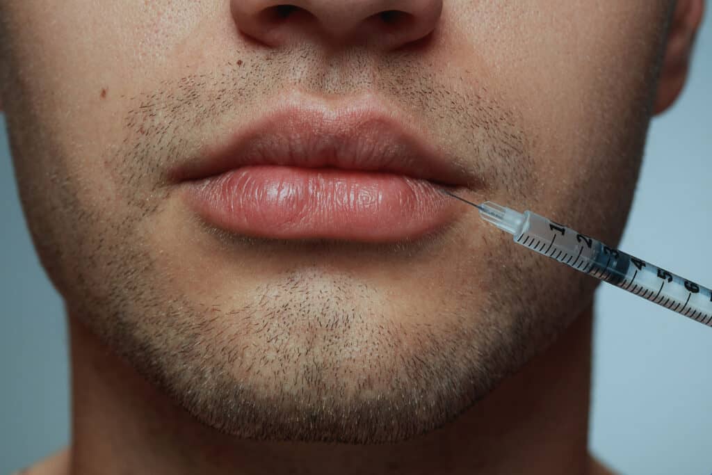 Powiększanie ust u mężczyzn RosaMed Clinic Warszawa