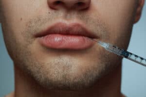 Powiększanie ust u mężczyzn RosaMed Clinic Warszawa
