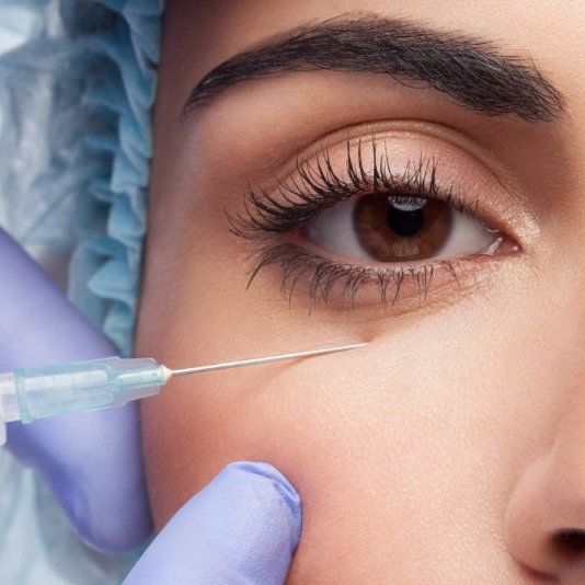 jakie-efekty-po-mezoterapii-iglowej-pod-oczami-1024x683